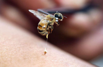 Friday Fun Fact – Bee Venom Therapy